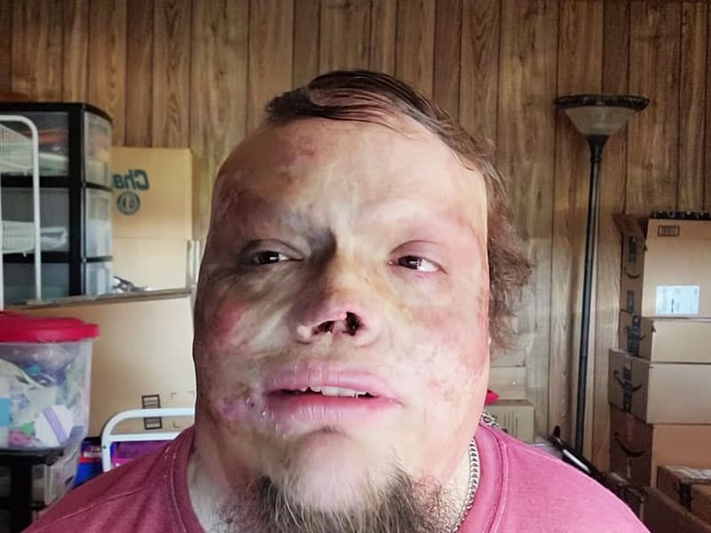 Body burned testimony