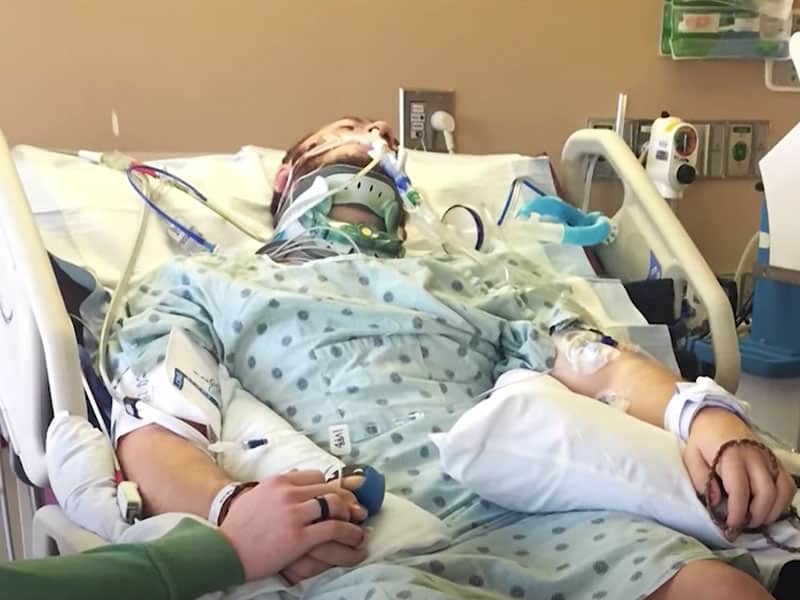 Young man shot on face miracle