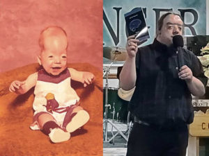 Baby born without brain preacher